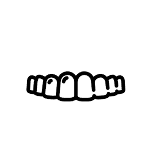 Veneers
